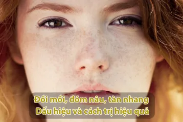 Nguyên nhân, cách trị đồi mồi đốm nâu tuổi trung niên hiệu quả