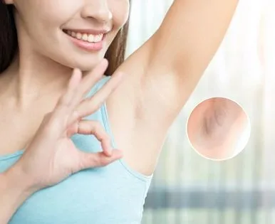 Địa Chỉ Spa Điều Trị Thâm Nách Uy Tín Tại Bình Tân