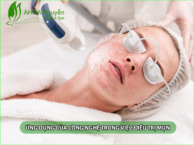 ỨNG DỤNG CỦA CÔNG NGHỆ TRONG VIỆC ĐIỀU TRỊ MỤN