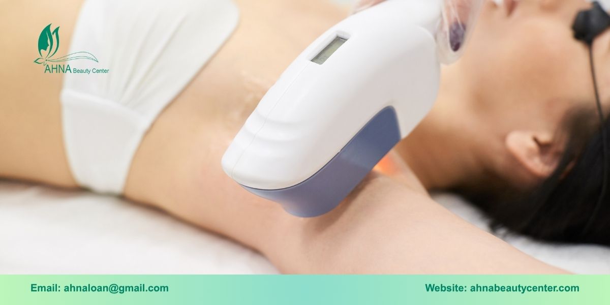 Các dịch vụ trị hôi nách phổ biến