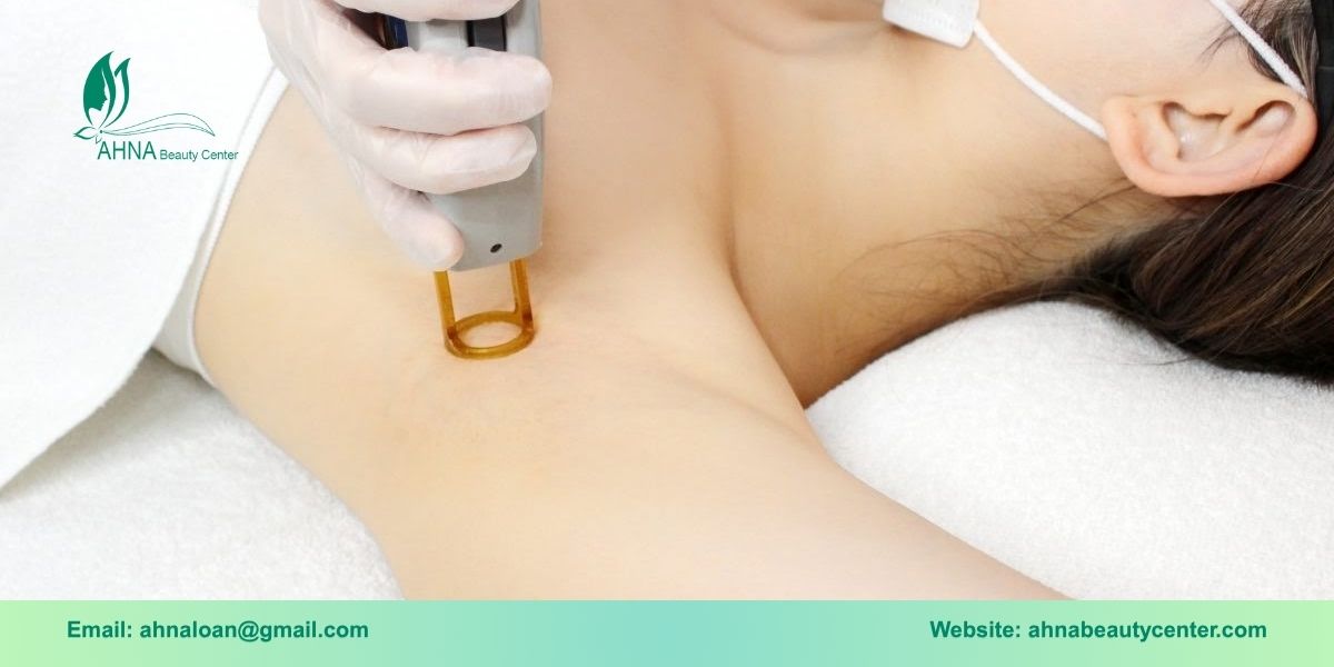 Các liệu trình trị liệu thâm nách tại An Lạc của Ahna Beauty