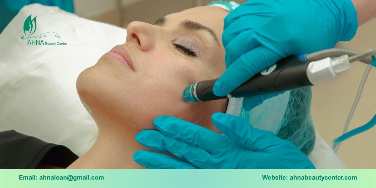 Các liệu trình trị mụn chuyên nghiệp tại An Lạc của Ahna Beauty