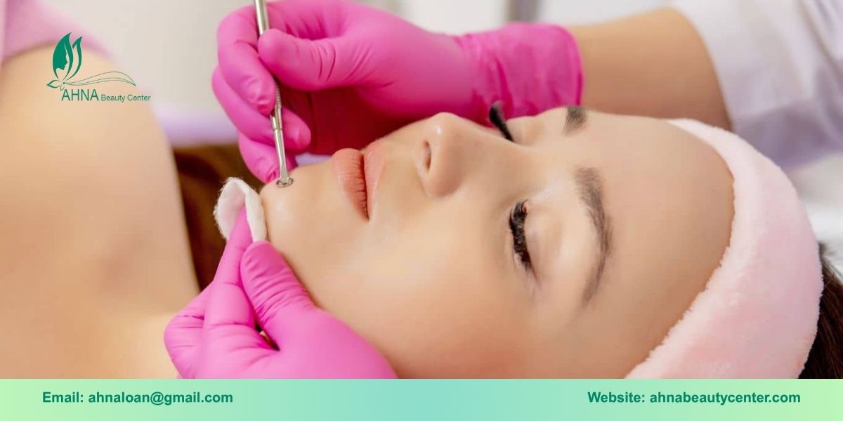 Chi phí dịch vụ trị liệu mụn tại An Lạc