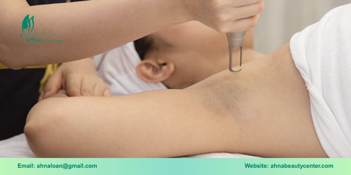 Chi phí trị liệu thâm nách tại Bình Tân