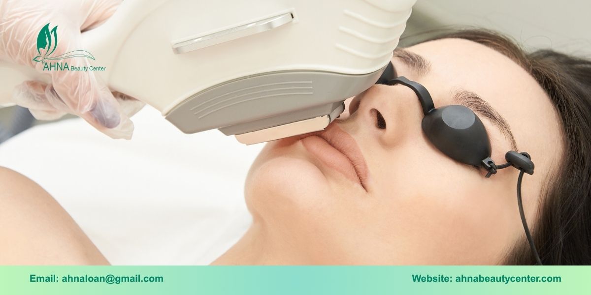 Công nghệ IPL trong điều trị mụn