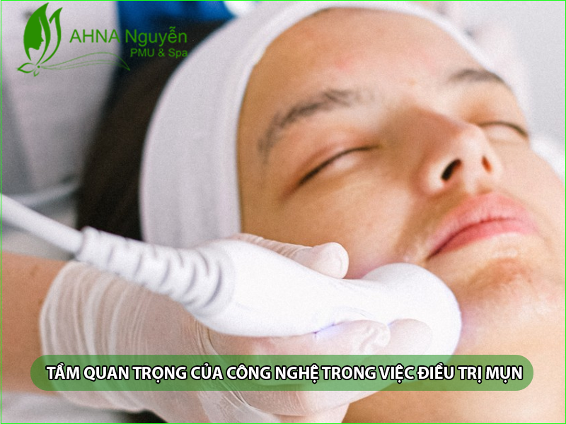 dieu tri mun bang cong nghe