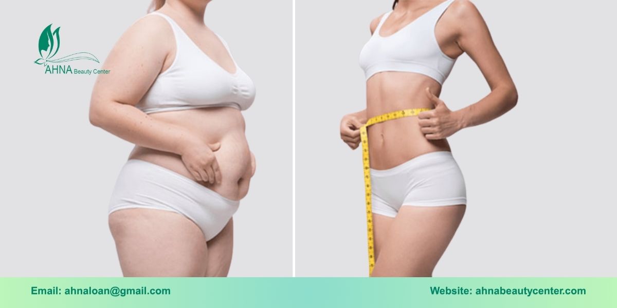 Giới thiệu dịch vụ trị liệu giảm béo tại An Lạc của Ahna Beauty