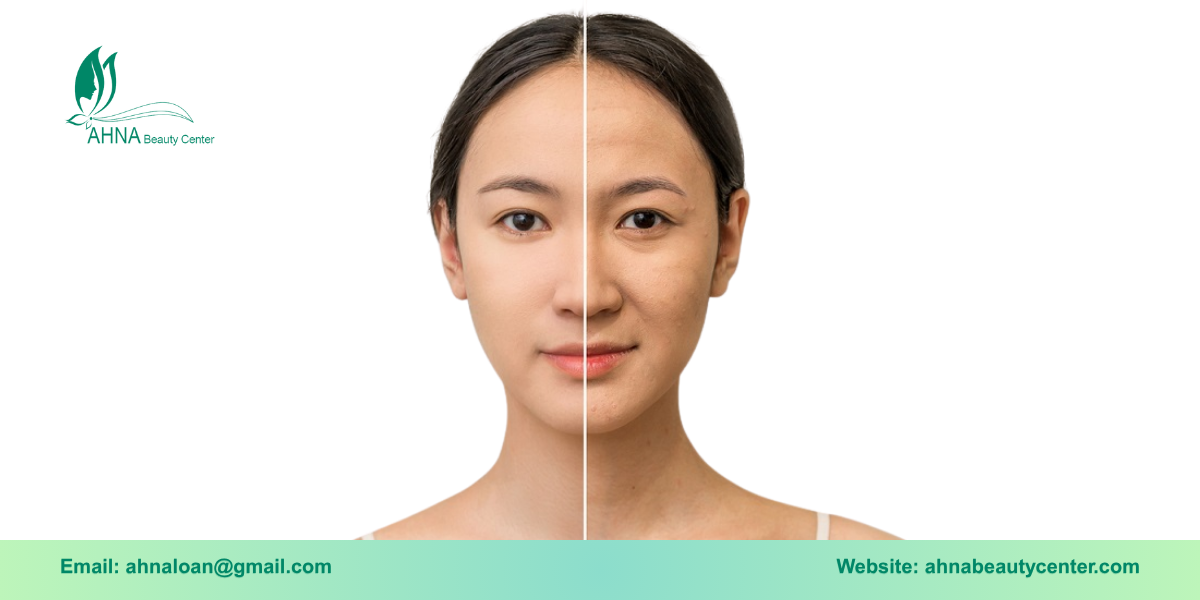 Giới thiệu dịch vụ trị liệu lão hóa da tại An Lạc đến từ Ahna Beauty