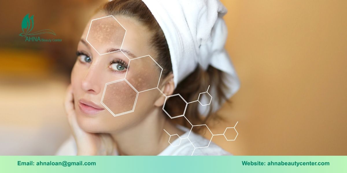 Giới thiệu dịch vụ trị liệu nám tại Bình Tân của Ahna Beauty