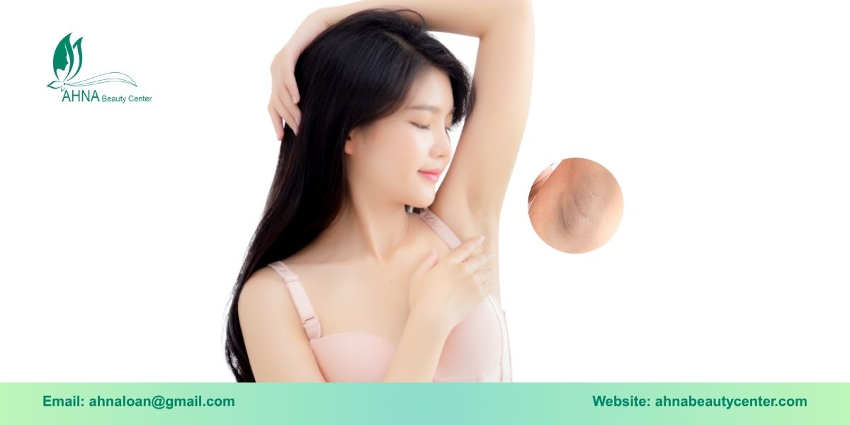 Giới thiệu dịch vụ trị liệu thâm nách tại An Lạc của Ahna Beauty