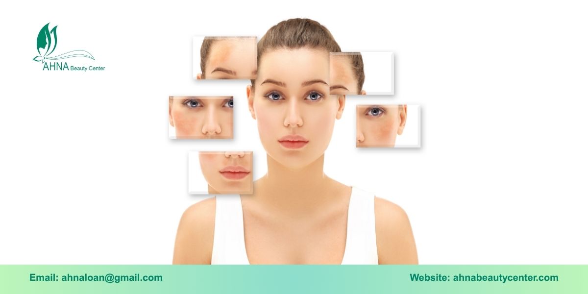 Giới thiệu dịch vụ trị liệu tổn thương sắc tố da tại Bình Tân của Ahna Beauty