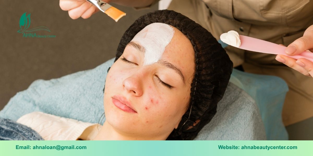 Giới thiệu về dịch vụ trị liệu da mụn chuyên sâu của Ahna Beauty
