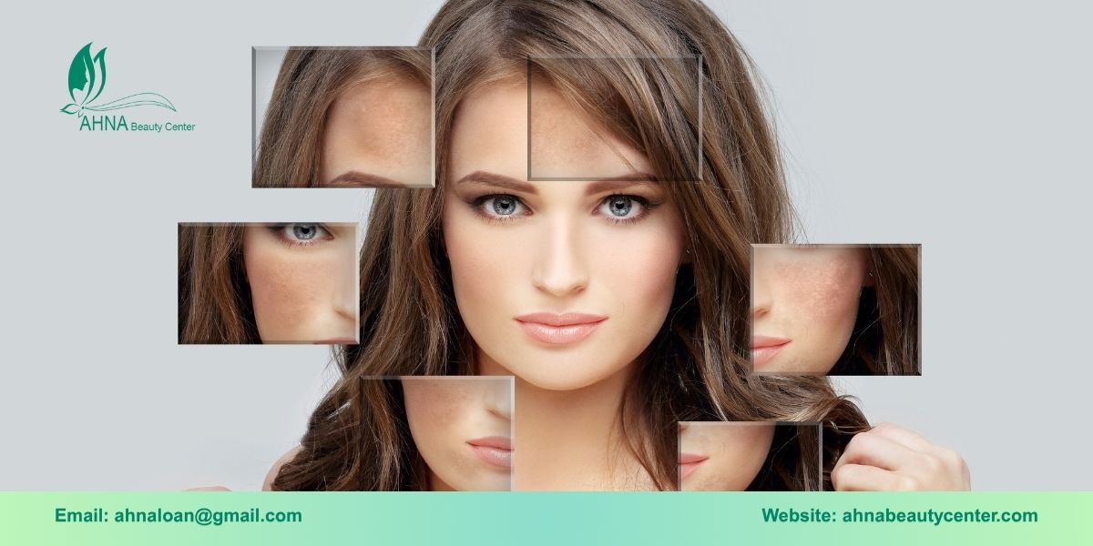 Giới thiệu về liệu trình trị liệu tổn thương sắc tố da tại Ahna Beauty