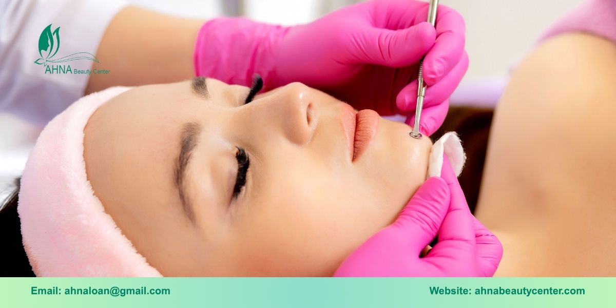 Lưu ý khi chọn spa trị mụn tại Bình Tân