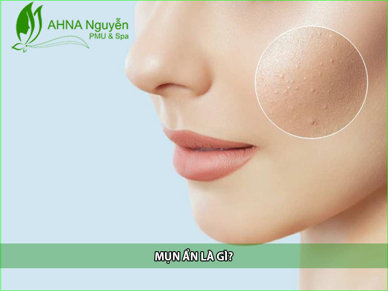 mun an la gi