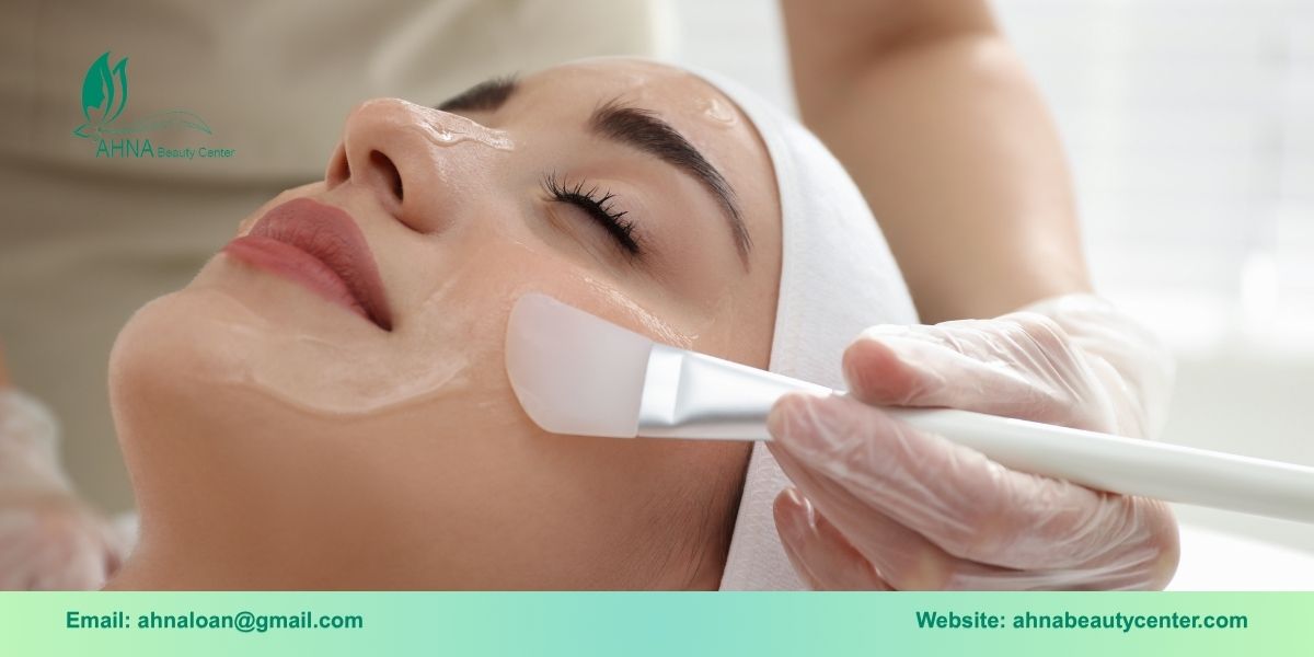 Peel da hóa học trị mụn