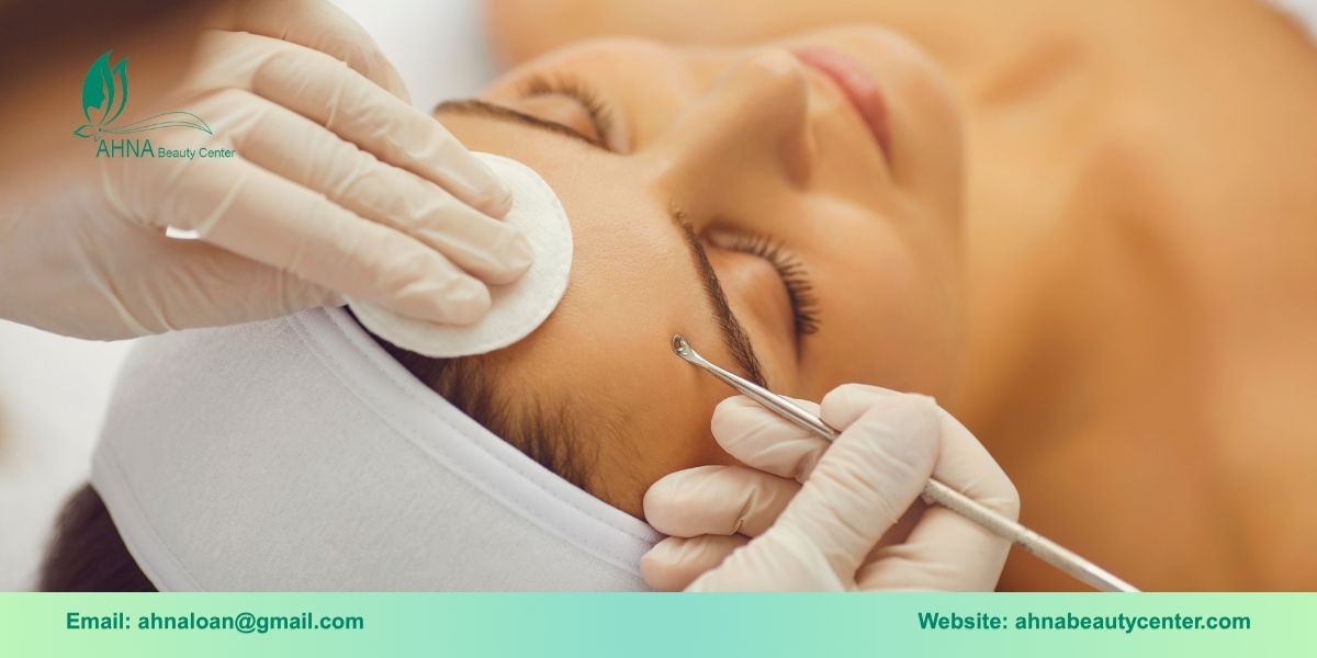 Trị liệu mụn chuyên sâu uy tín tại Ahna Beauty