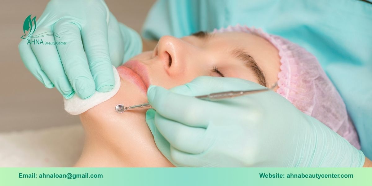 Ưu điểm khi điều trị mụn tại các spa chuyên sâu