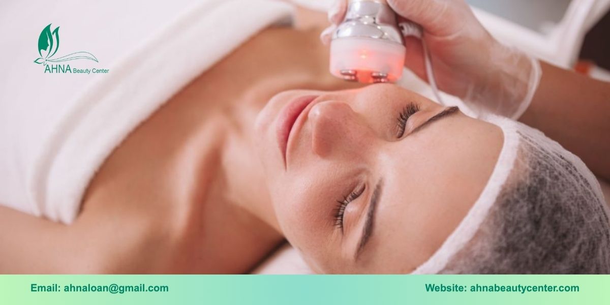 Ưu và nhược điểm của công nghệ RF 